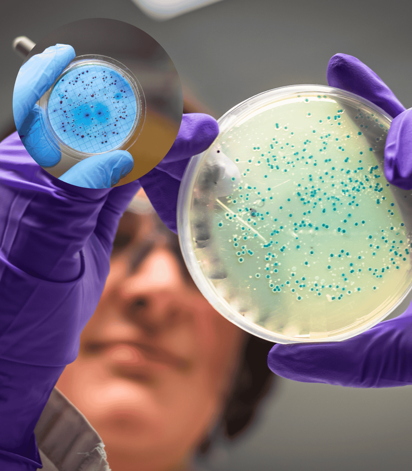 Microbial Disinfection